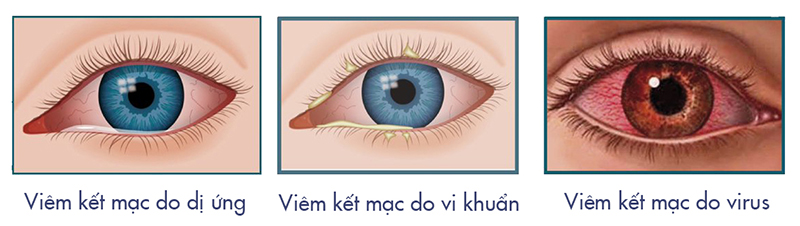 https://kinhmatquanganh.vn/